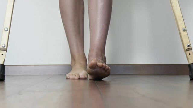 A woman after a broken leg to learn to walk. Rehabilitation after removal of plaster bandage. A woman walks on crutches.