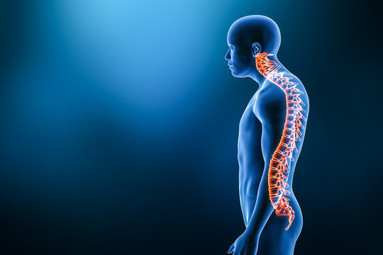 Kyphosis pathology with man model from lateral view 3D rendering illustration with copy space. Human anatomy, spinal deformity, curvature of the spine, backbone pathology, medical concepts.