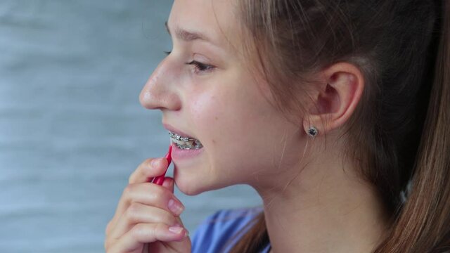 Girl with braces cleaning teeth 