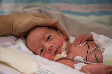 Premature newborn baby in incubator - obrazy, fototapety, plakaty
