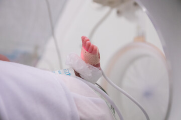 Foot of premature newborn baby in incubator (Soft)