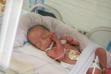 Premature newborn baby in incubator (Soft)