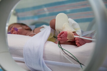 Foot of premature newborn baby in incubator