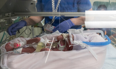 Nurse caring Premature newborn baby in incubator