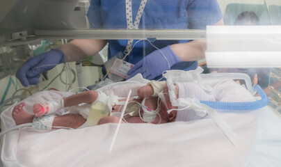 Nurse caring Premature newborn baby in incubator (Soft)