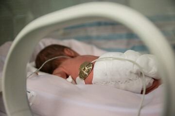 Premature newborn baby in incubator back
