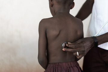 Male healthcare professional auscultating the lungs of a small black boy during respiratory tract examination