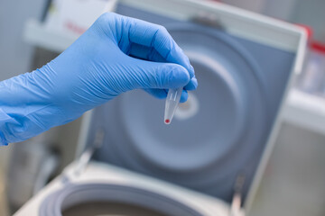 Laboratory technician isolates blood cells