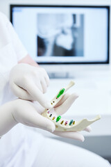 Dentist implantologist showing dental implant technology on human tooth jaw model