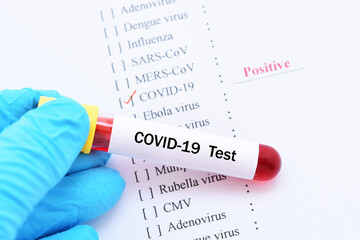 Obraz premium Laboratory report of COVID-19 test, the result showed positive 