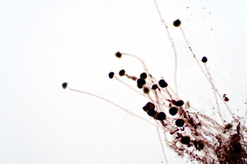 Aspergillus (mold) under the light microscopic view.