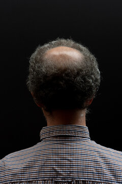 Close up of back of head of a balding man.