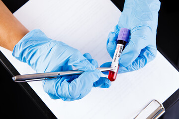 blood test in the hands of the doctor .blood  test with the label Covid-19 DELTA Variant.