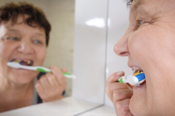 woman with problem teeth cleans them in the bathroom