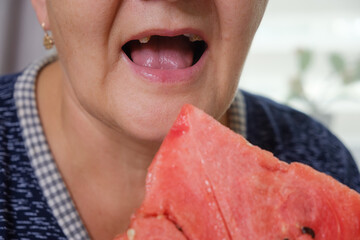 woman with problem teeth eating juicy watermelon