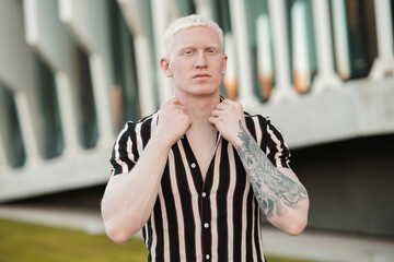 albino man, casual clothes outdoors, grabs his shirt