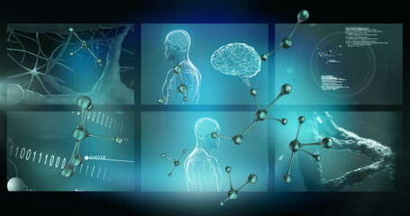 Image of medical data processing on screens