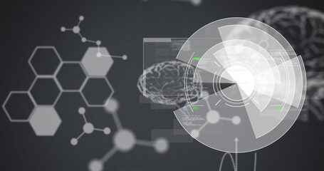 Image of scope scanning, medical data processing and human brain
