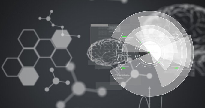 Image of scope scanning, medical data processing and human brain