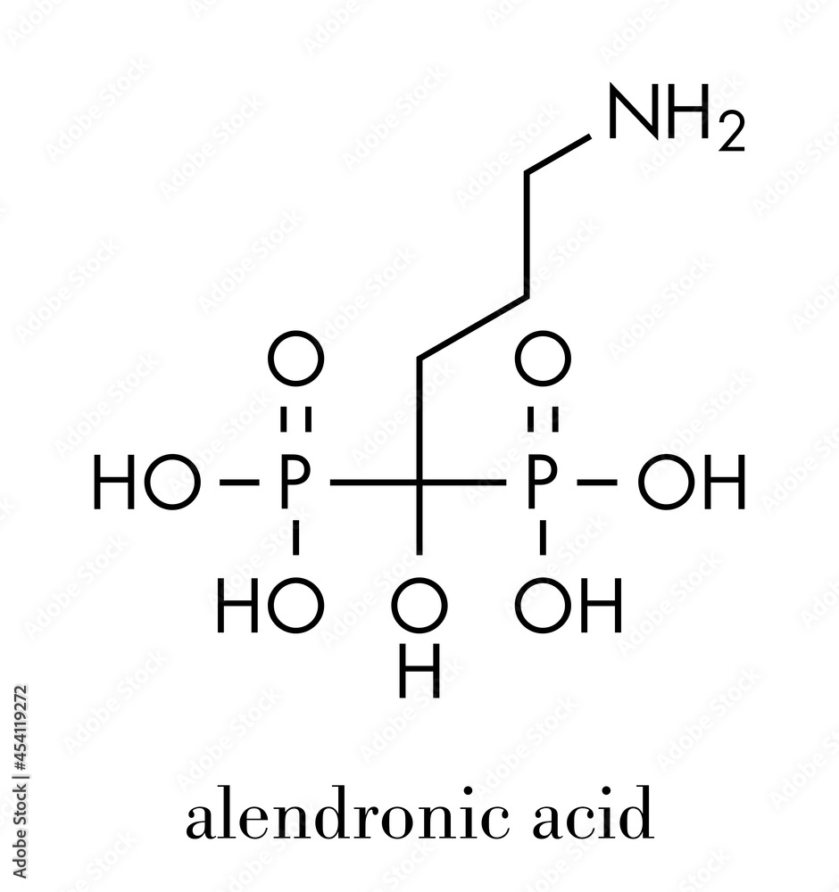 Wall mural Alendronic acid (alendronate, bisphosphonate class) osteoporosis drug molecule. Skeletal formula.