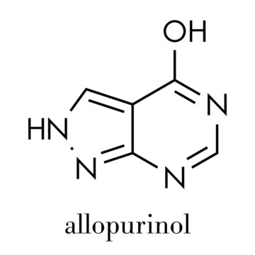 Allopurinol gout drug molecule. Skeletal formula.