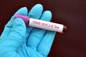Test tube with blood sample for COVID-19 C.1.2 variant test, new variant epidemic in South Africa