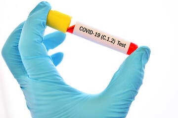 Test tube with blood sample for COVID-19 C.1.2 variant test, new variant epidemic in South Africa
