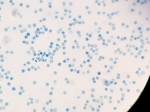 Reticulocyte count from blood smear Hematology