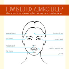 Vector illustration. How is Botox Administered.