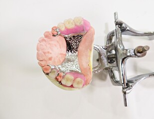 maxillary parial wax denture