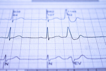 Heartbeat recorded on graph paper called an electrocardiogram. Study of the functioning of the heart post COVID-19.