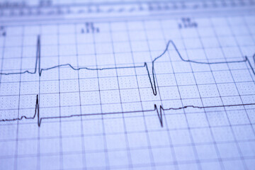 Heartbeat recorded on graph paper called an electrocardiogram. Study of the functioning of the heart post COVID-19.