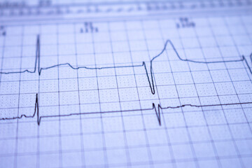 Heartbeat recorded on graph paper called an electrocardiogram. Study of the functioning of the...
