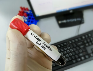 Scientist or Biochemist hold blood samples for Cortisol morning (9.0 am) test.