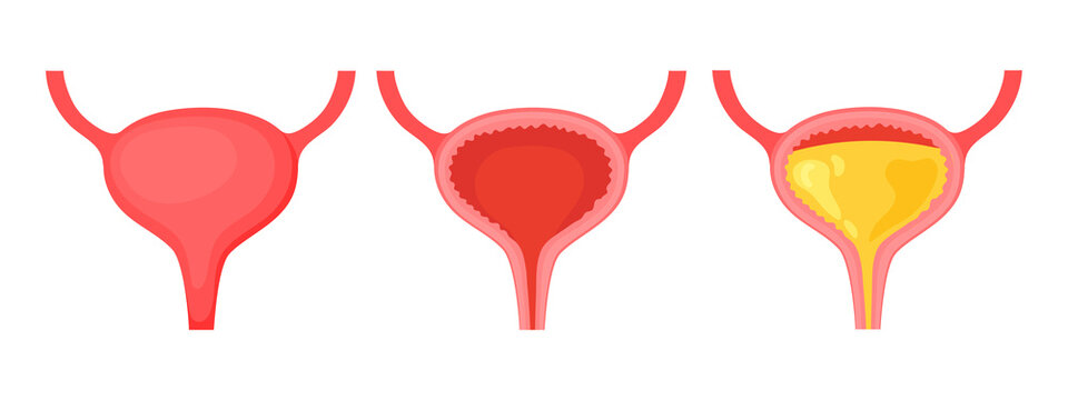 A full and empty bladder. Human organ anatomy. Medical, medical and scientific concepts. Educational infographics