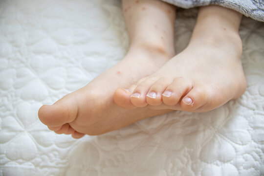close-up photo of the feets of a sleeping kid under a grey blanket. The kid has the nails uncuted.