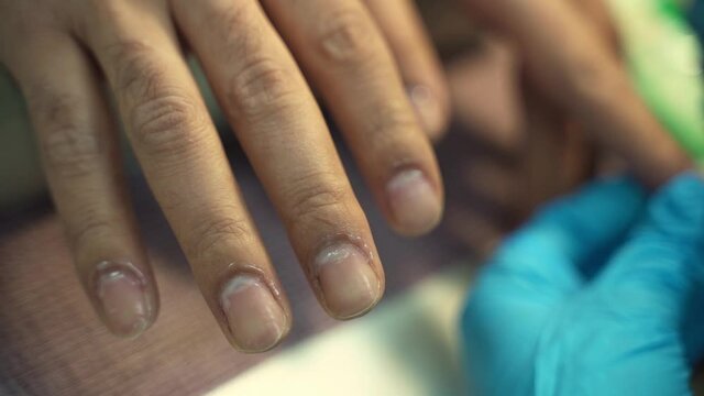 Man's nails on manicure with applied softening oil for cuticles in a beauty salon
