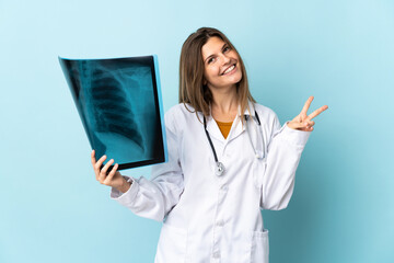 Young doctor woman holding radiography over isolated background smiling and showing victory sign