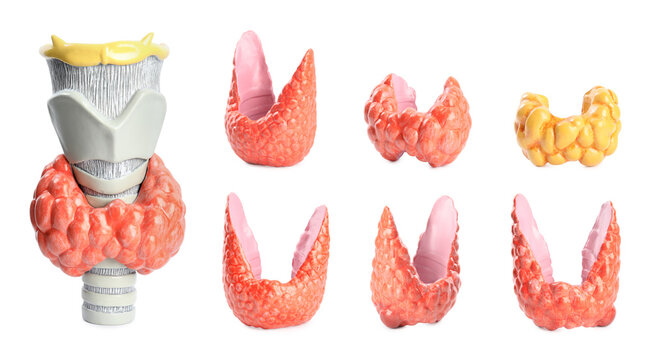Plastic models of healthy and afflicted thyroid on white background, collage