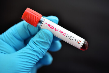 Obraz premium Mu variant COVID-19 positive, blood sample tube positive with mu variant of COVID-19 coronavirus