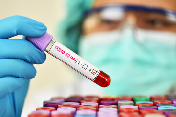 Mu variant COVID-19 positive, blood sample tube positive with mu variant of COVID-19 coronavirus