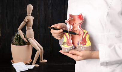 Doctor pointing at model of rectum with hemorrhoid, closeup. Wooden human figure, cactus and...