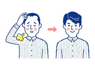 薄毛の進行と増毛のイメージ　ビフォーアフター