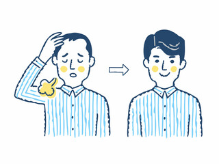 Obraz premium 薄毛の進行と増毛のイメージ ビフォーアフター