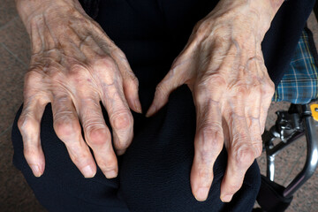 Fototapeta na wymiar 93-year-old elderly person. Close-up of female hands. 93歳の高齢者。 女性の手のクローズアップ。