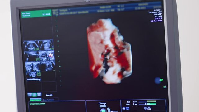 Ultrasound baby in a mother's womb. Ultrasound of pregnant woman. Scientific analysis