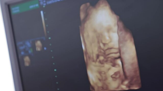 Ultrasound of baby in mother's womb. Pregnancy and Healthcare concept. Prenatal Screening.