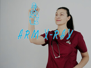 physicianwriting ARM X-RAY with marker