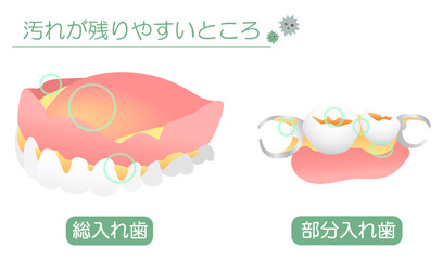 入れ歯の汚れが残りやすいところ
