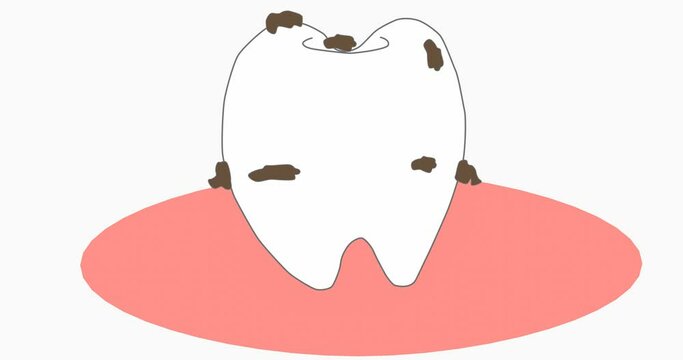 汚れが付着する歯のイメージ